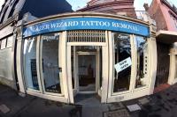 Lazer Wizard Tattoo Removal image 4
